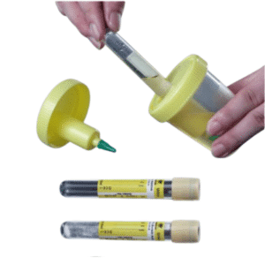 Urine Container Kit /w Needle