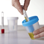 Urine Container Kit /w Needle